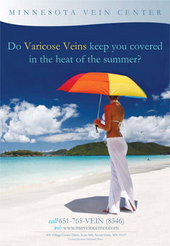 Do vericose veins keep you covered in the heat of summer?